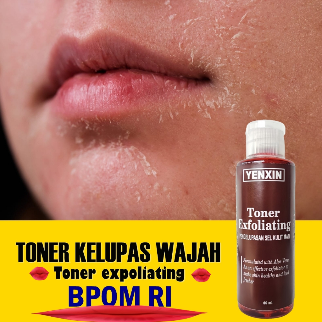 TONER KELUPAS WAJAH, TONER Whitening, TONER KELUPAS WAJAH GLOWING - 1 BOTOL YENXIN BPOM  TONER EXFOL