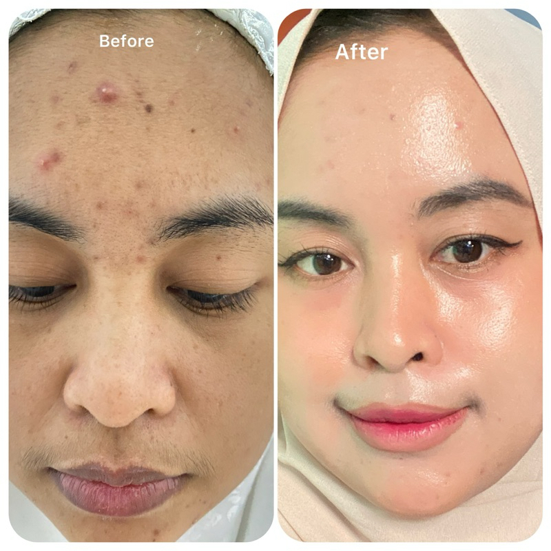 paket pemutih wajah BPOM ampuh(CASSIA Beauty Care) memutihkan,mnecerahkan cock untuk kulit susah put