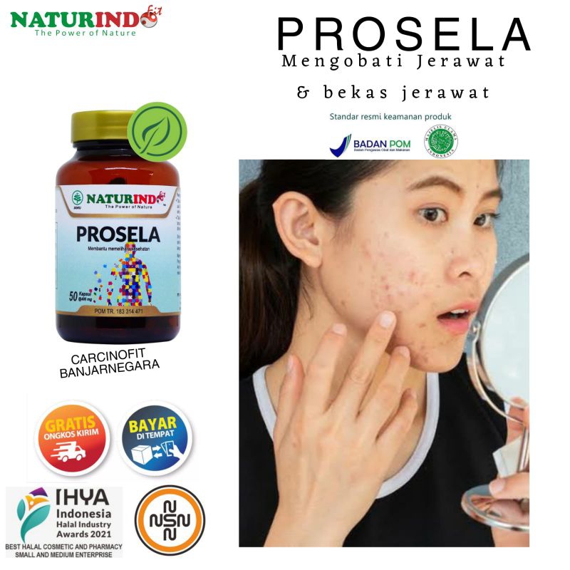 Obat Bekas Jerawat Bopeng PROSELA Naturindo