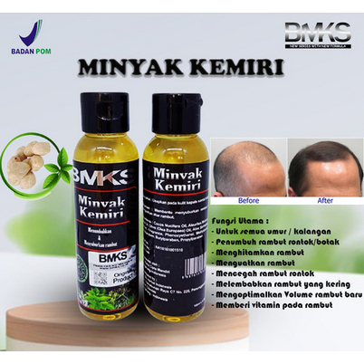 BMKS MINYAK KEMIRI BPOM MENUMBUHKAN DAN MENYUBURKAN RAMBUT