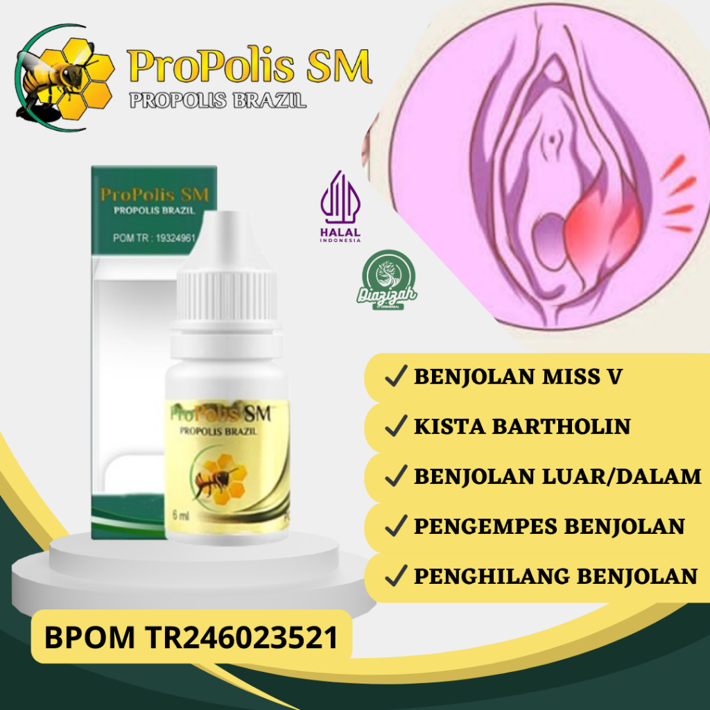 Obat Benjolan di Miss V, Obat Kista Bartholin, Obat Penghilang Benjolan, Obat Benjolan Miss V di Bag