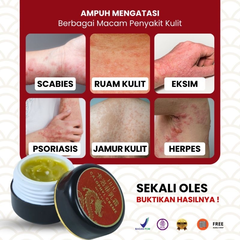 Salep Herpes Herbal Ampuh Salep Anti Jamur