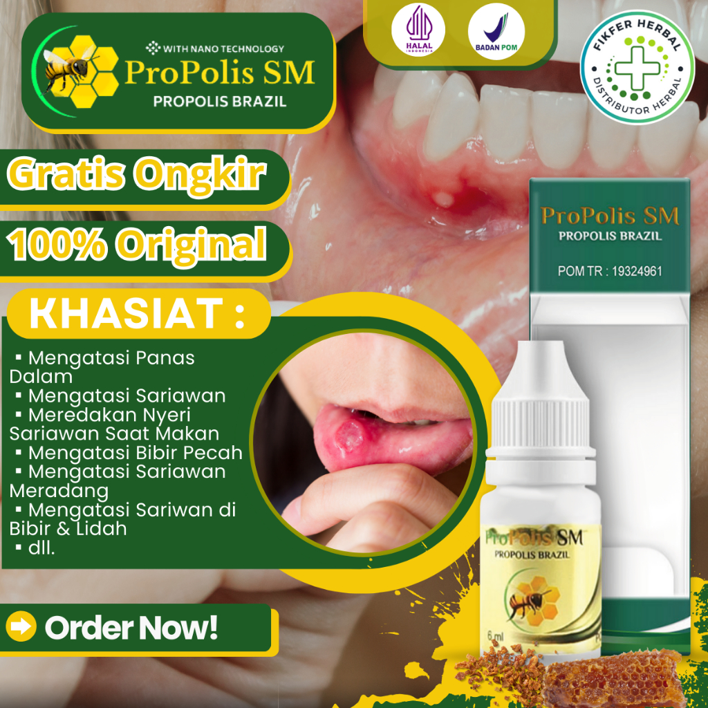 [BISA COD] Obat Tetes Sariawan, Obat Sariawan Parah, Sakit Bibir Akibat Sariawan, Obat Sariawan di L