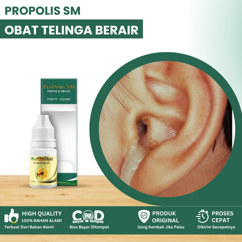 Obat Telinga Berair, Obat Telinga Bernanah Dan Bau, Obat Congek Menahun, Obat Telinga Kotor, Telinga