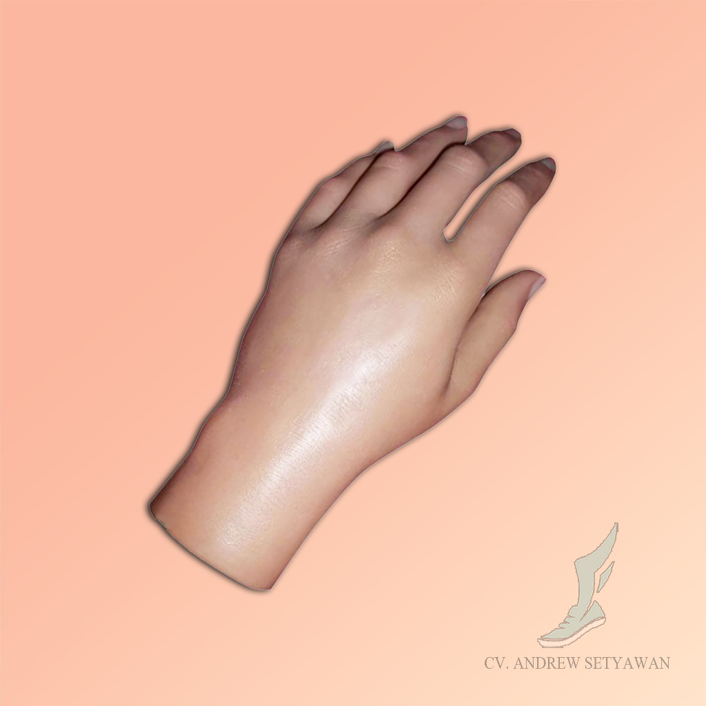 Tangan Palsu Pada Pergelangan Tangan