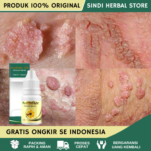 Obat Kutil Kelamin Salep Kutil Kelamin Perontok Kutil Kelamin Penghilang Kutil Kelamin Penghancur Ku