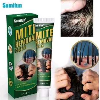 Cream gatal gatal kulit kepala dan borok kulit kepala