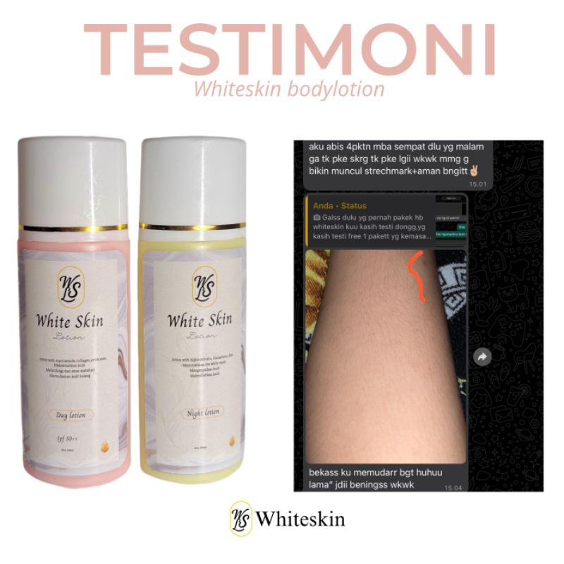 whiteskin lation