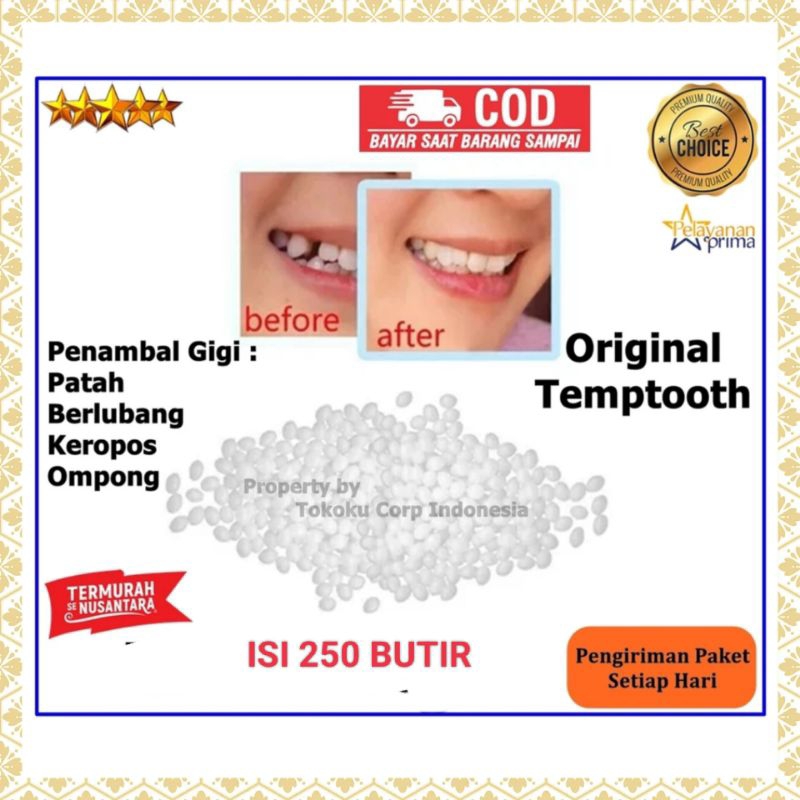 isi 250 butir gigi palsu sementara penambal gigi tempthooth gigi palsu bahan alat tambal gigi sendir