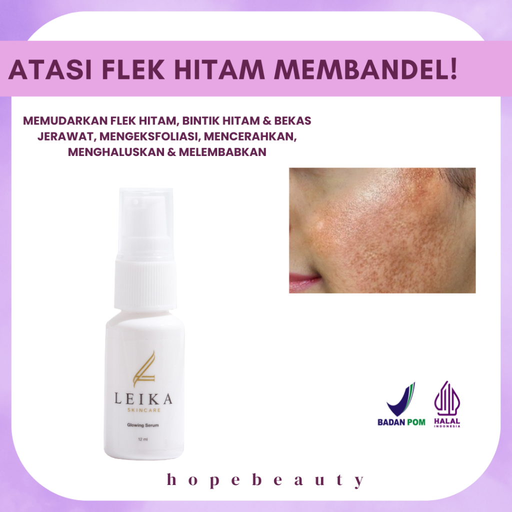 SERUM Untuk Menghilangkan Flek Hitam Menghilangkan Flek Hitam Di Wajah Serum Flek Hitam Membandel Pe