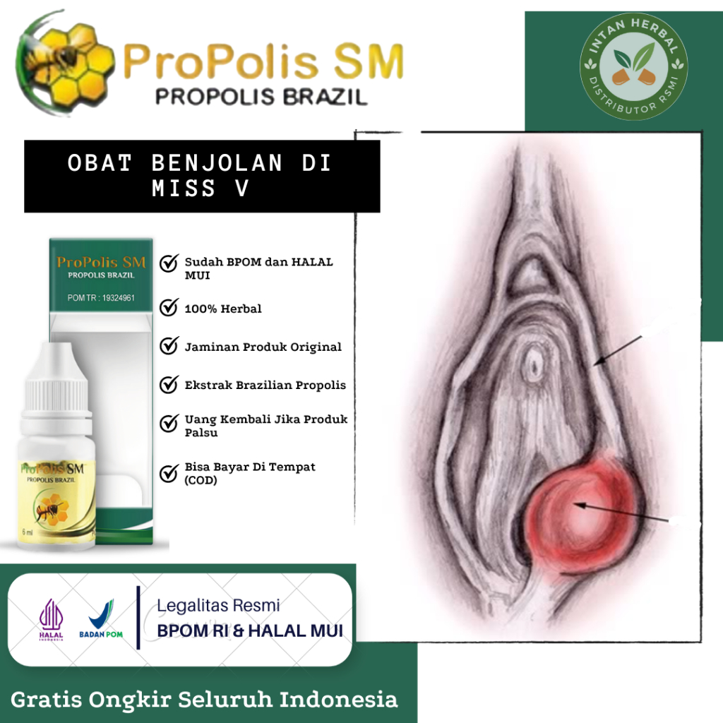 Obat Oles Benjolan di Miss V, Miom, Kista Ovarium, Benjolan di Bibir Vagina, Kutil Kelamin, Jengger 