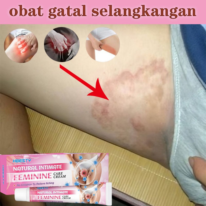 Obat gatal selangkangan salep jamur kulit salep eksim salep gatal paling ampuh salep gatal 20g Kulit