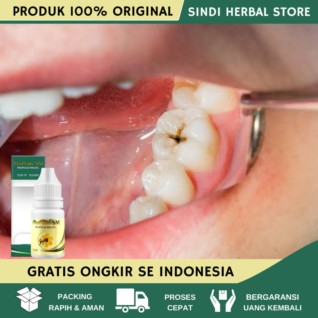 Obat Sakit Gigi Berlubang, Obat Sakit Gigi, Obat Gigi Keropos Berlubang, Obat Penghilang Gusi Bengka