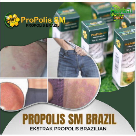 Obat penghilang flek hitam di selangkangan, pemutih, jamur, Memutihkan selangkangan, Salep Untuk inf