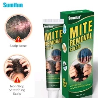 Obat Psoriasis di Kepala Ketombe Parah Gatal Kulit Kepala Jamur Kulit Kepala Borok di Kepala Dermati