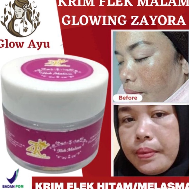 COD NEWPRODUCT Krim Penghilang Flek Paling Ampuh FlekHitam Hilang dalam seminggguKrim Flek Malam Zay