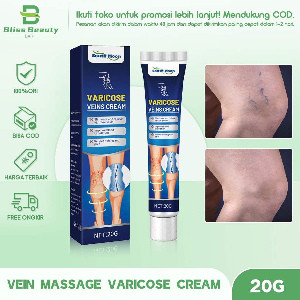 South Moon Varicose Veins Cream 20g  Penghilang Parises salep untuk varises Salep Perawatan Koyo Oba