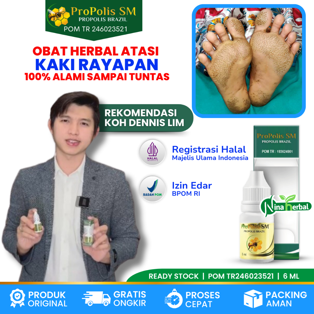 Obat Oles Kaki Rayapan, Obat Kaki Rayapan Bau, Obat Kaki Rayapan Berlubang, Obat Telapak Kaki Berlub