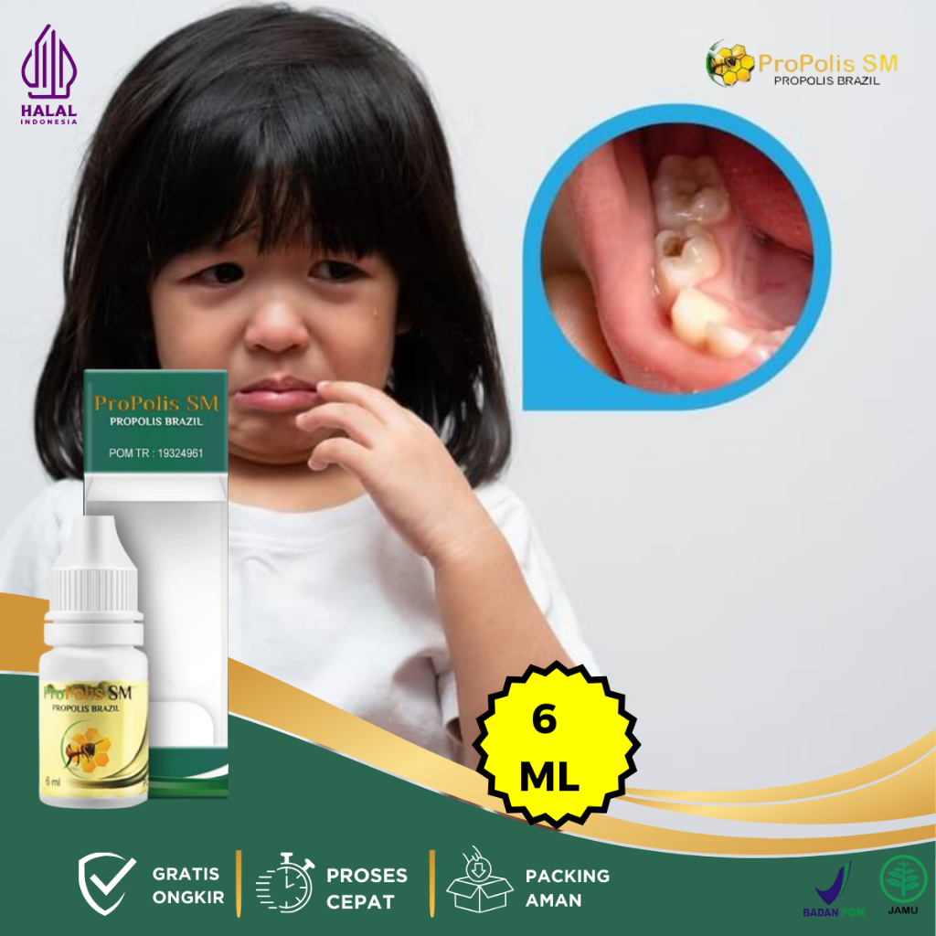 Obat Sakit Gigi Berlubang, Obat Gusi Bengkak, Obat Gusi Berdarah, Obat Gigi Berlubang, Obat Gigi Ngi