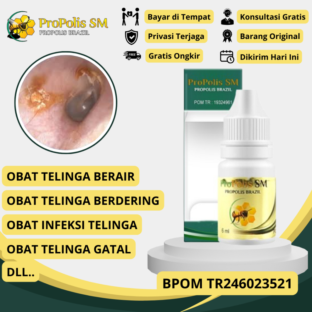 Obat Telinga Berair, Obat Telinga Gatal, Obat Infeksi Telinga, Obat Otitis Media, Obat Kotoran Telin