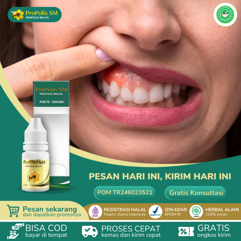 Propolis SM Obat Gusi Menyusut Radang Gusi Resesi Gingiva Infeksi Bengkak Gusi Bernanah Benjolan