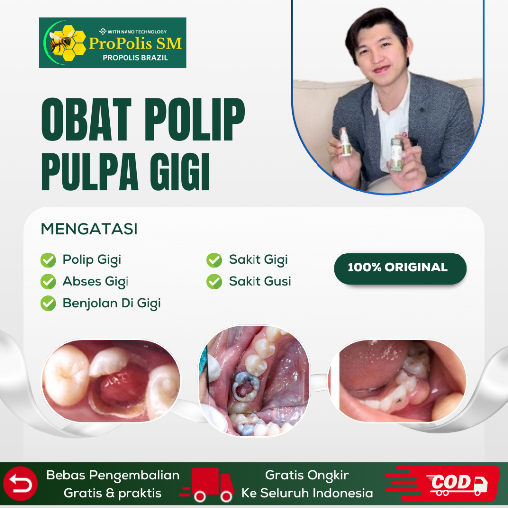 Obat Polip Gigi, Obat Polip Pulpa, Obat Abses Gigi, Obat Benjolan Di Gigi, Obat Sakit Gigi, Polip Gu