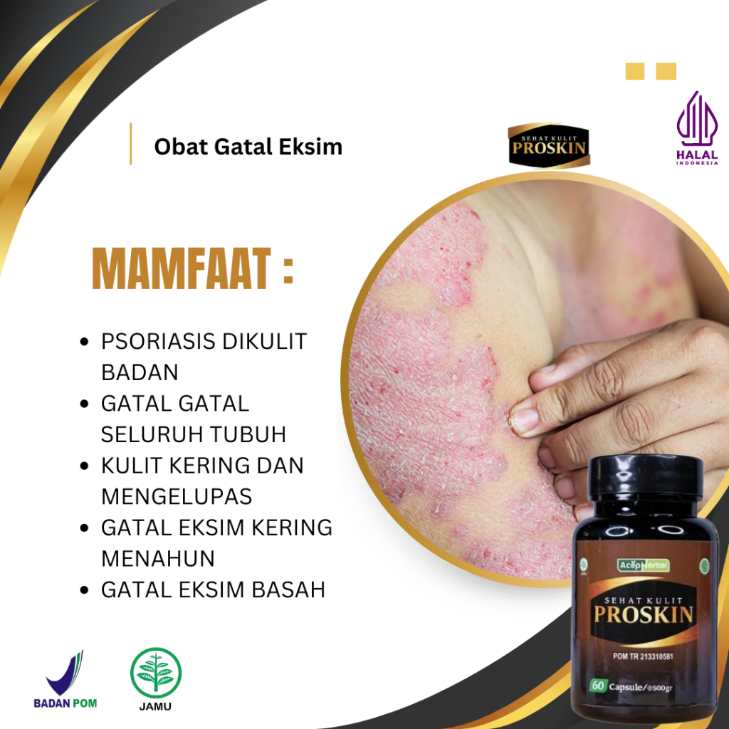 Obat Gatal Seluruh Badan, Obat Gatal Kulit Eksim, Obat Jamur Kulit Gatal, Obat Eksim Kering Menahun,