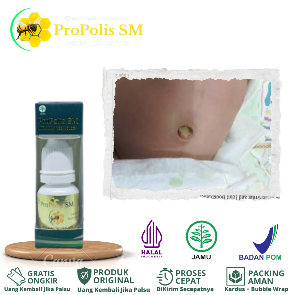 Obat Pusar Bernanah, Salep Pusar Berair, Obat Udel Berdarah, Obat Pusar Gatal Dan Hitam, Obat Luka D