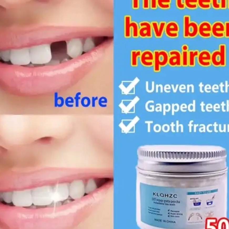 FG2 ORI Penambal Gigi Berlubang Sementara Isi 5g18Butir  Gigi Palsu Buatan Sendiri Temporary Tooth  