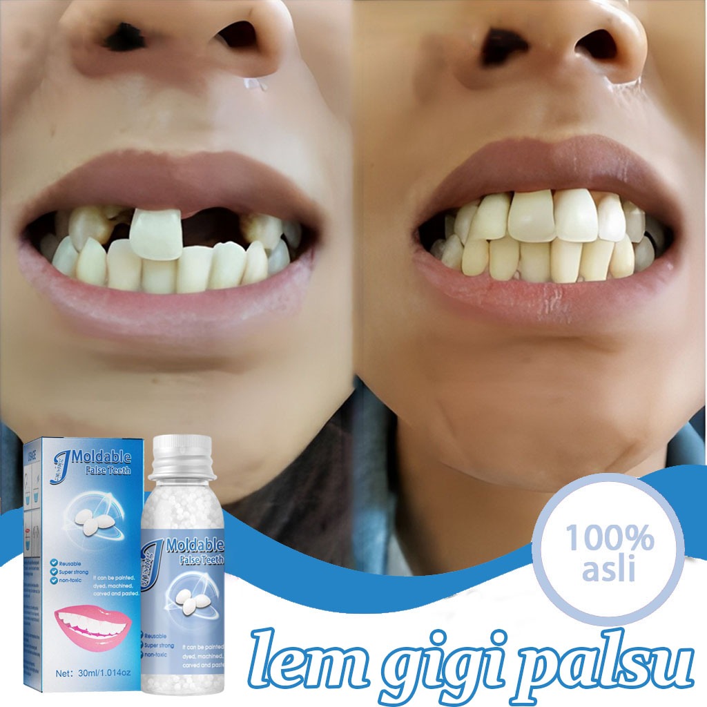 penambal gigi berlubang gigi palsu asli dokter permanen tambal gigi permanen 30ML lem gigi palsu per