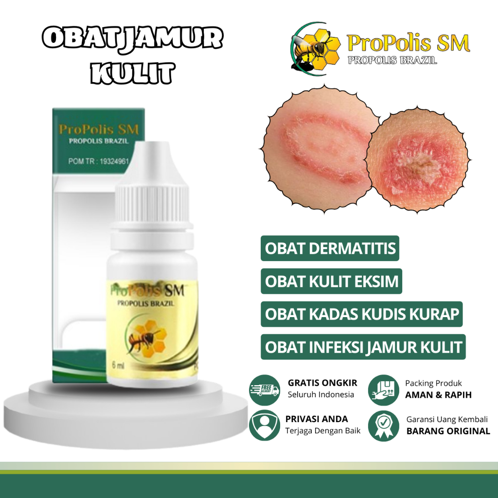 Obat Jamur Kulit, Obat Kulit Kurap, Obat Kulit Panu, Obat Kulit Kadas, Obat Kulit Eksim, Obat Kulit 