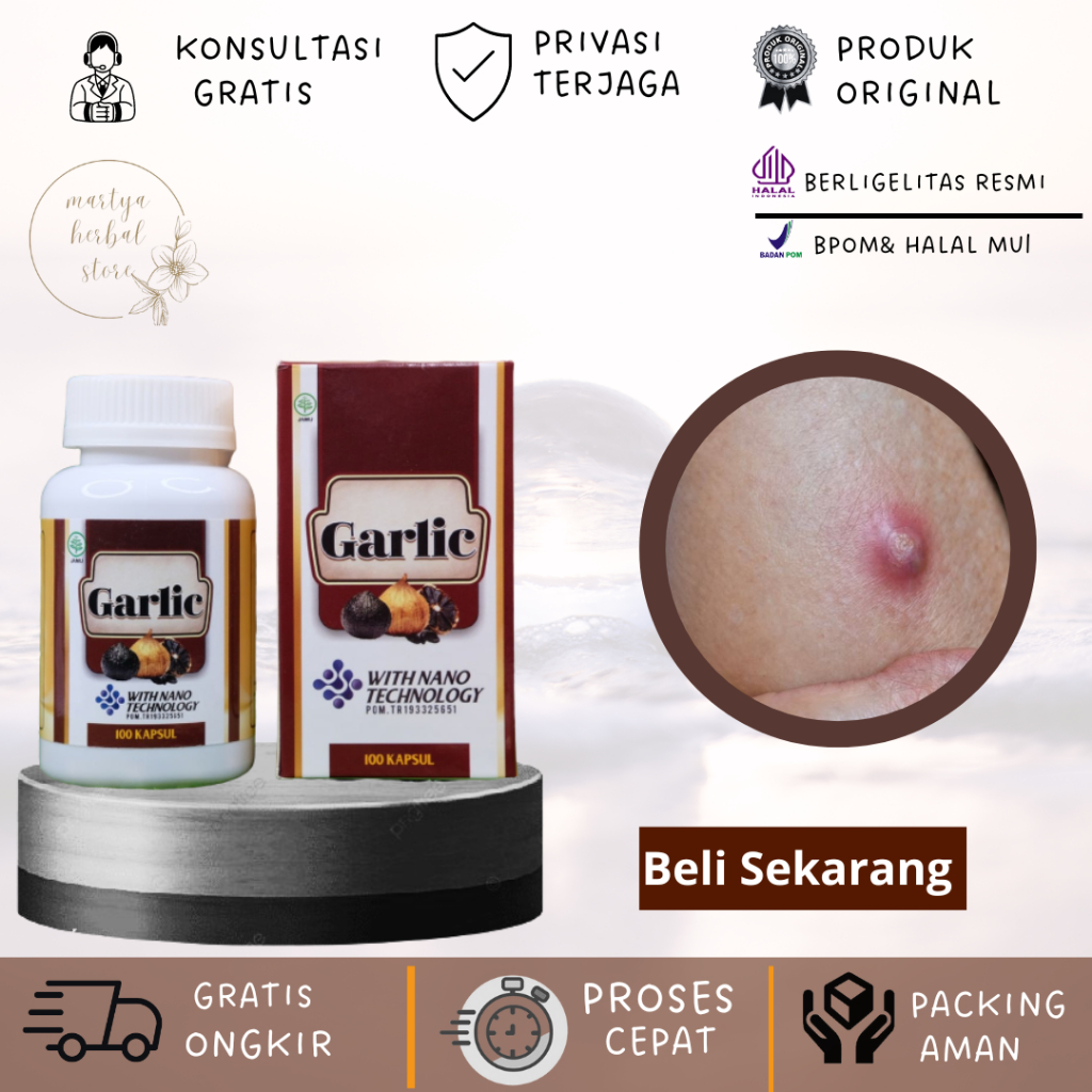 Obat Herbal Bisul Bernanah Obat Bisul Agar Cepat Pecah Obat Bisul Tanpa Mata Obat Bisul Di Pantat De