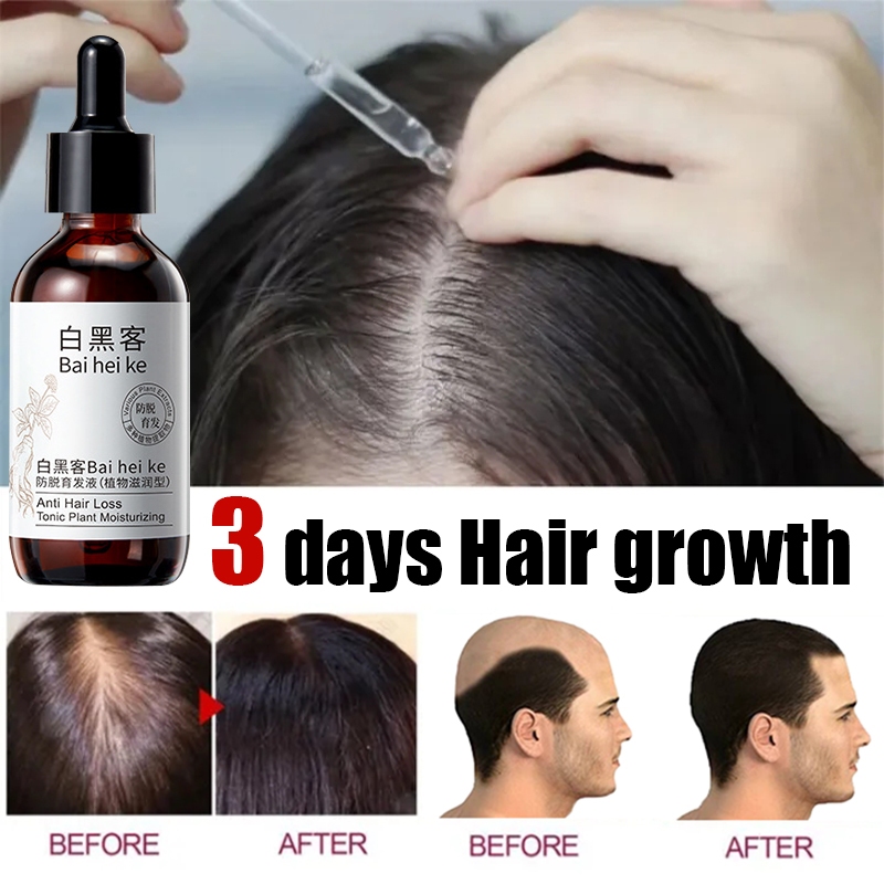 Penumbuh rambut serum Penumbuh rambut botak Penumbuh rambut cepat 60ml Rambut cepat tumbuh Mencegah 