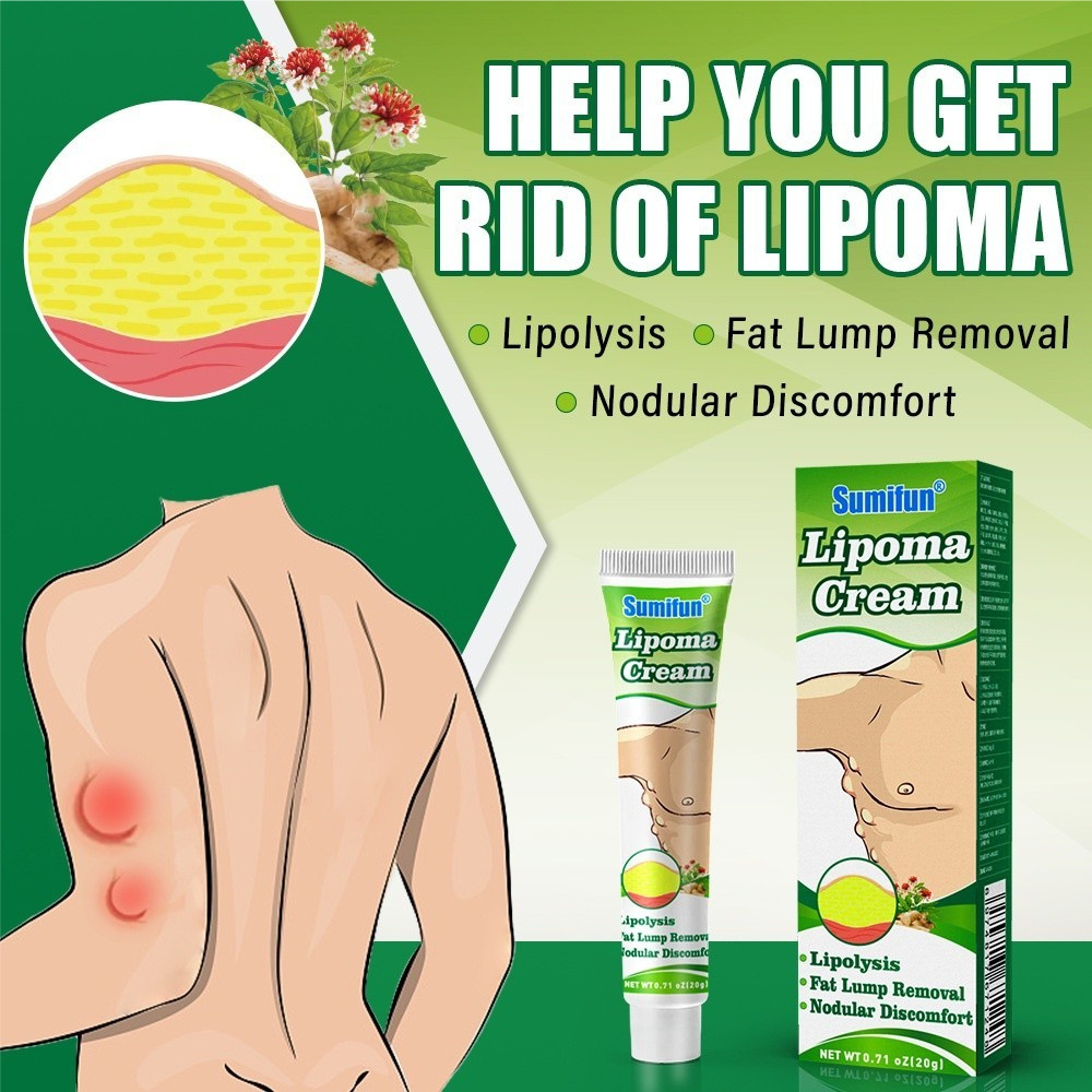 [Barang asli] Lipoma Cream Obat Benjolan Lipoma Krim Benjolan Di Leher Tangan Ketiak