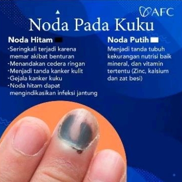 SOP SUBARASHII DAN UTSUKUSHII 100% ORIGINAL PRODUK JEPANG