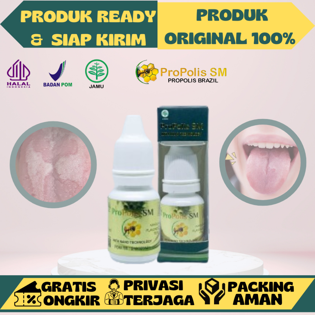 Propolis SM  Obat Herbal Radang Lidah Obat Bercak Lidah Putih Obat  Sariawan Lidah Dewasa Obat Lidah