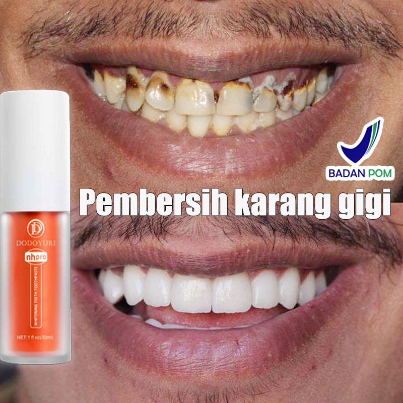 Odol pemutih gigi dan karang gigi Penghilang karang gigi Pembersih karang gigi Alat pembersih karang