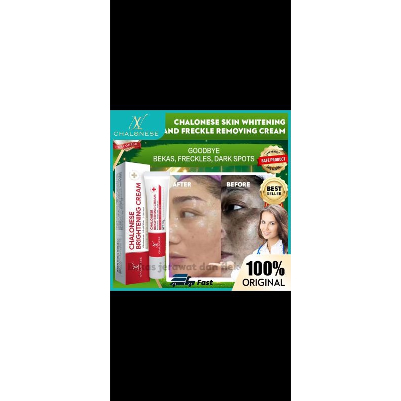 CHALONESE CREAM PEMUTIH WAJAH BPOM CREAM WHITENING AND FRECKLE REMOVAL