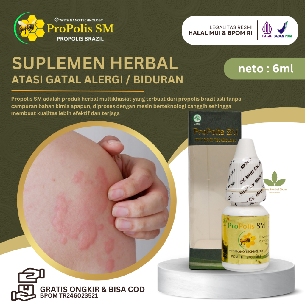 Propolis SM Brazil Obat Alergi Dingin, Obat Gatal Alergi Dingin, Obat Alergi Kulit, Obat Alergi Ding