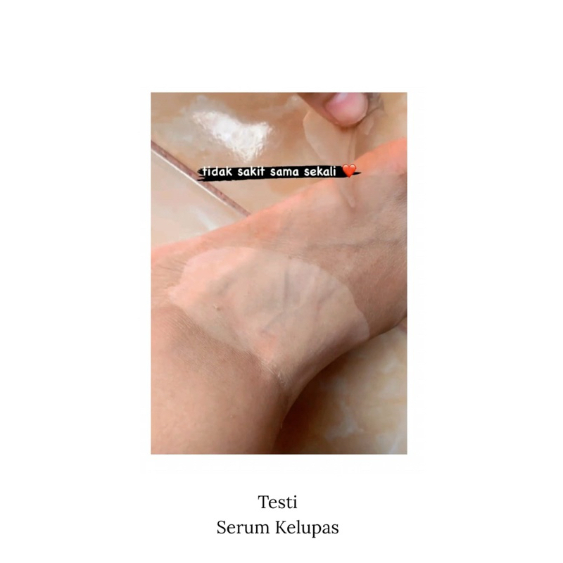 BODY SERUM PEELING / KELUPAS