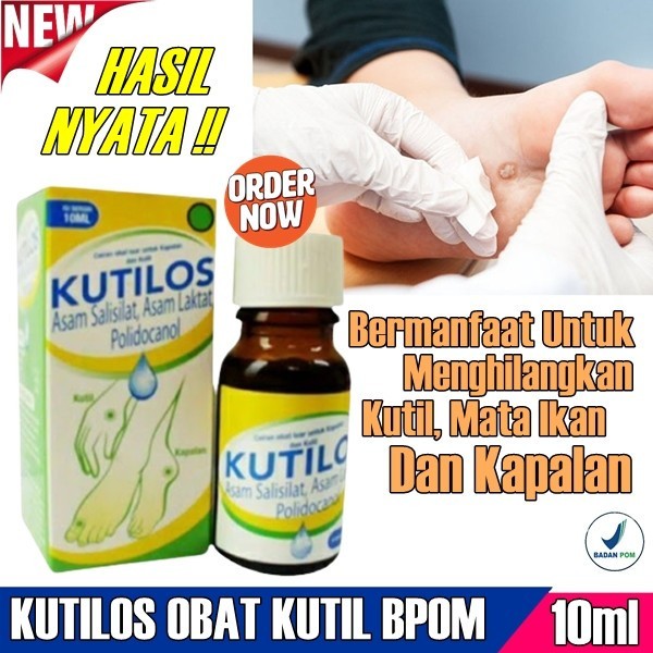 PENGHILANG KUTIL KUTILOS
