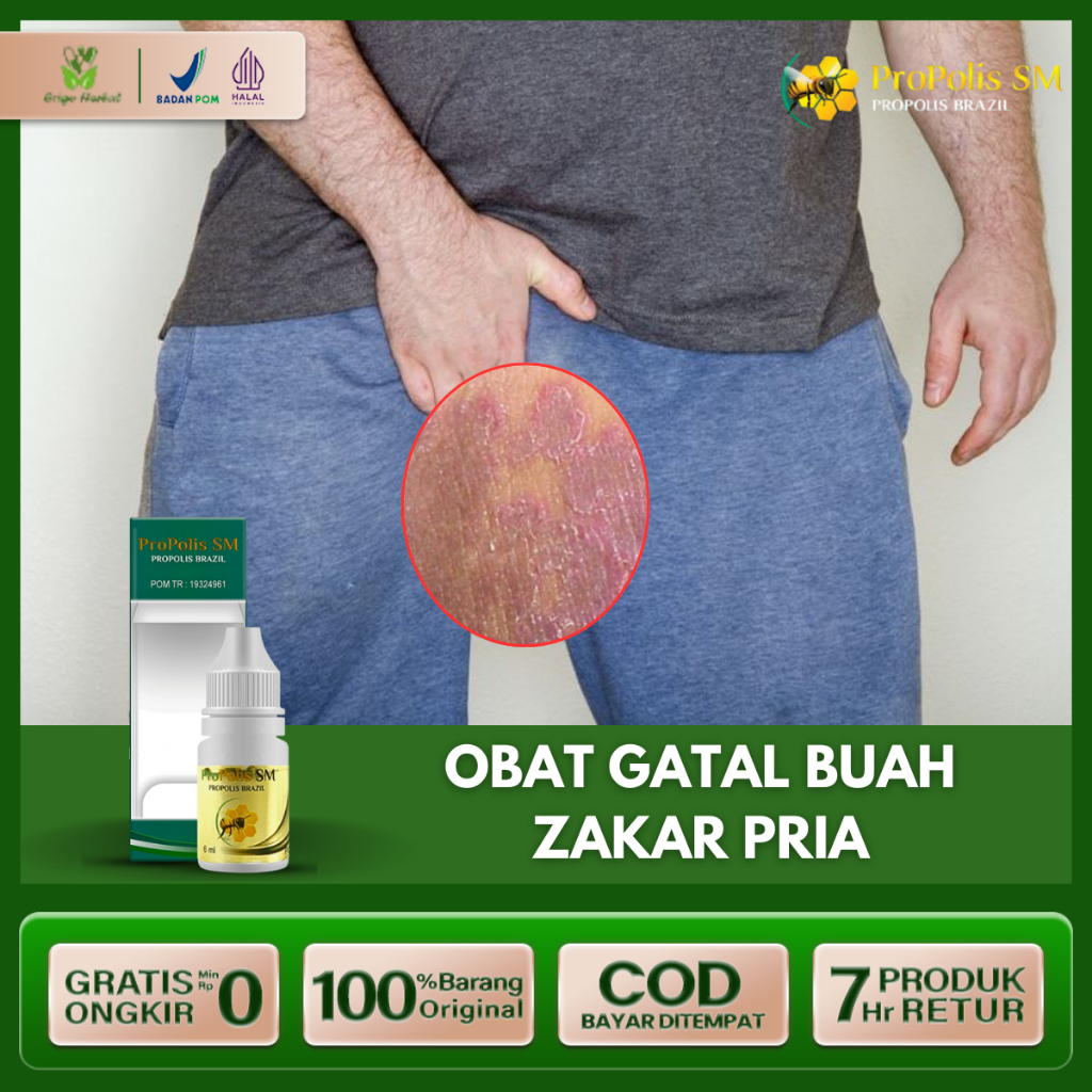 Obat Gatal Buah Zakar Pria,Buah Zakar Bengkak kering Buah Zakar Ruam Obat Gatal Kelamin Propolis SM