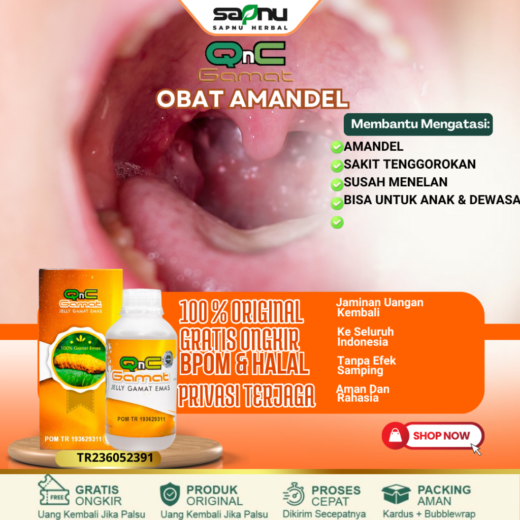 Obat Amandel, Radang Tenggorokan, Penghancur Amandel, Radang Amandel, Amandel Akut dan Kronis, Infek