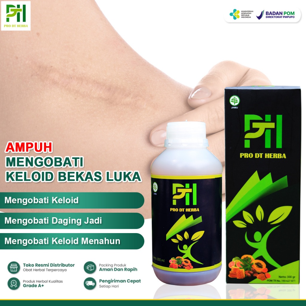 Obat Keloid, Penghilang Keloid, Keloid Menonjol, Anti Keloid, Herbal Untuk Menghilangkan Bekas Luka 