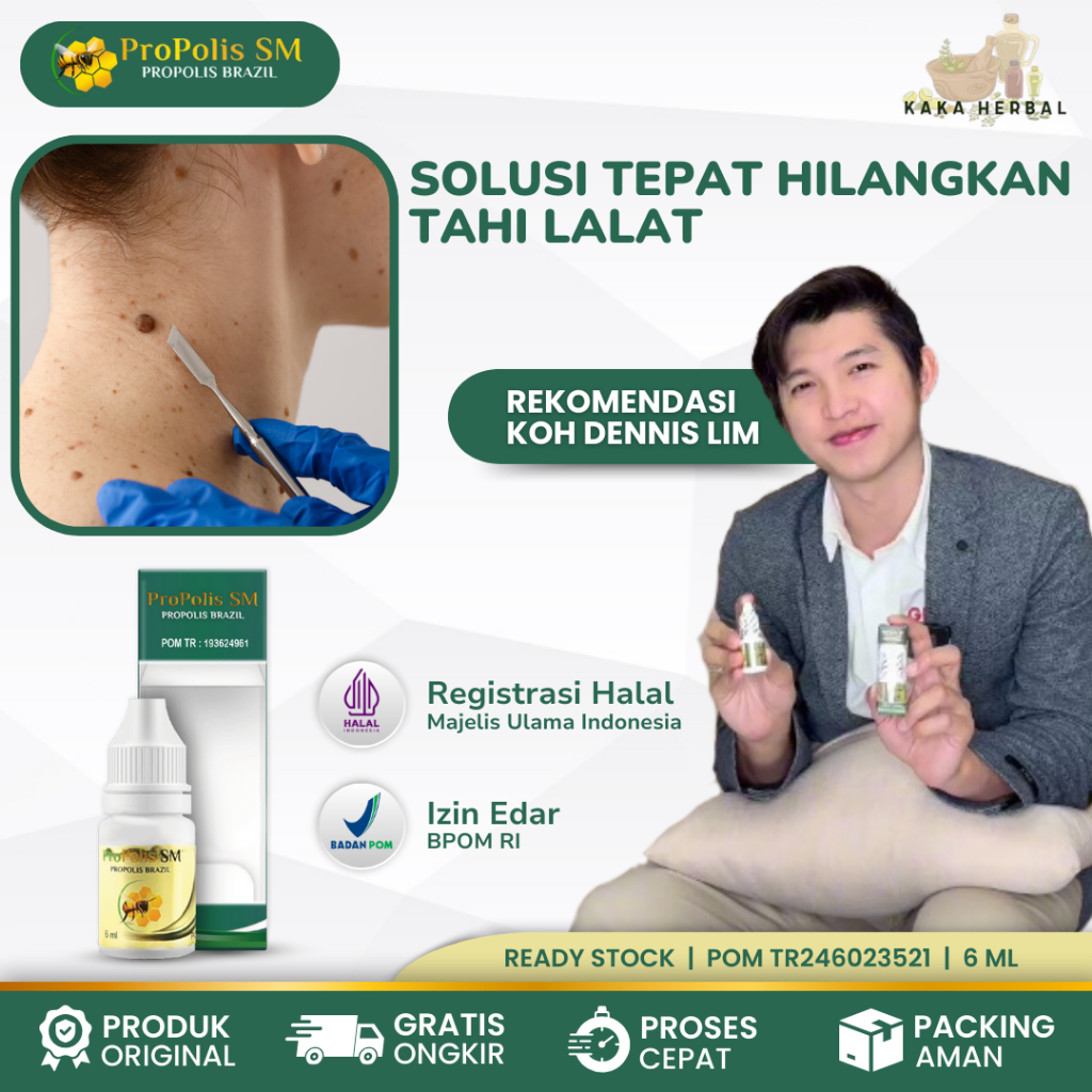Kaka Herbal - Obat Tahi Lalat, Obat Tahi Lalat Di Wajah, Obat Tahi Lalat Tanpa Bekas, Obat Tahi Lala