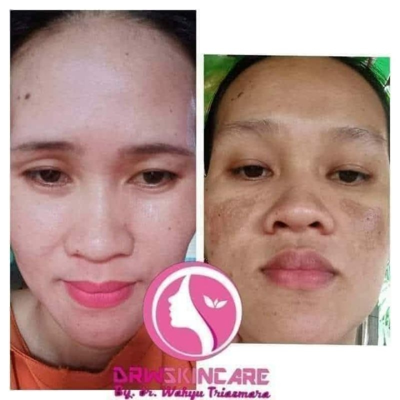 Berbagai produk kecantikan dr drw skincare