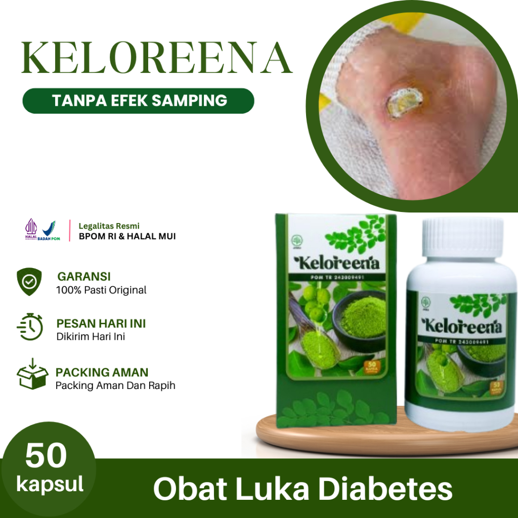 Obat Luka Diabetes, Luka Diabetes Melitus, Luka Basah Diabetes, Luka Diabetes Bernanah, Luka Koreng 