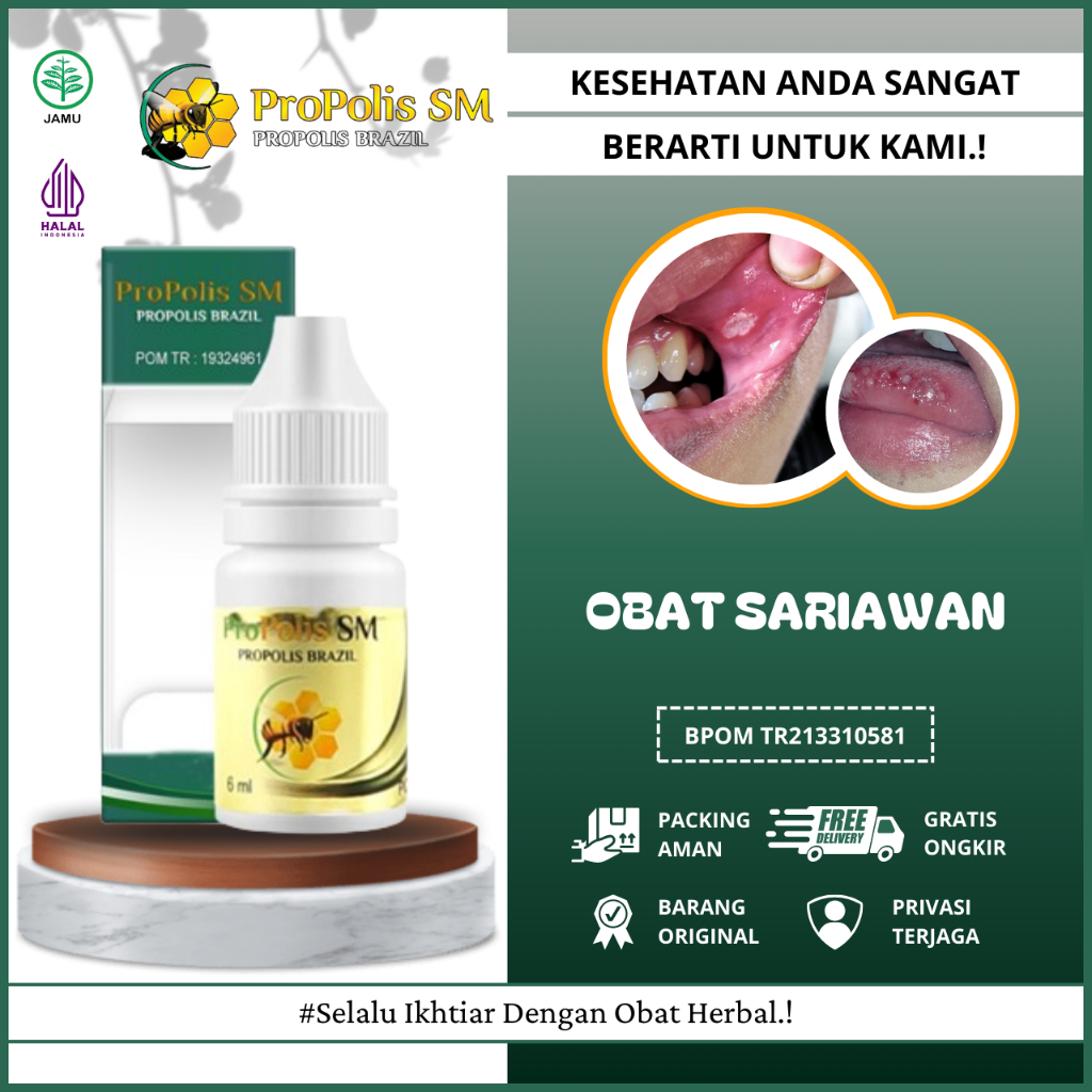 Obat Sariawan di Mulut, Obat Sariawan di Lidah, Obat Sariawan di Bibir Mulut, Obat Sariawan di Gusi,