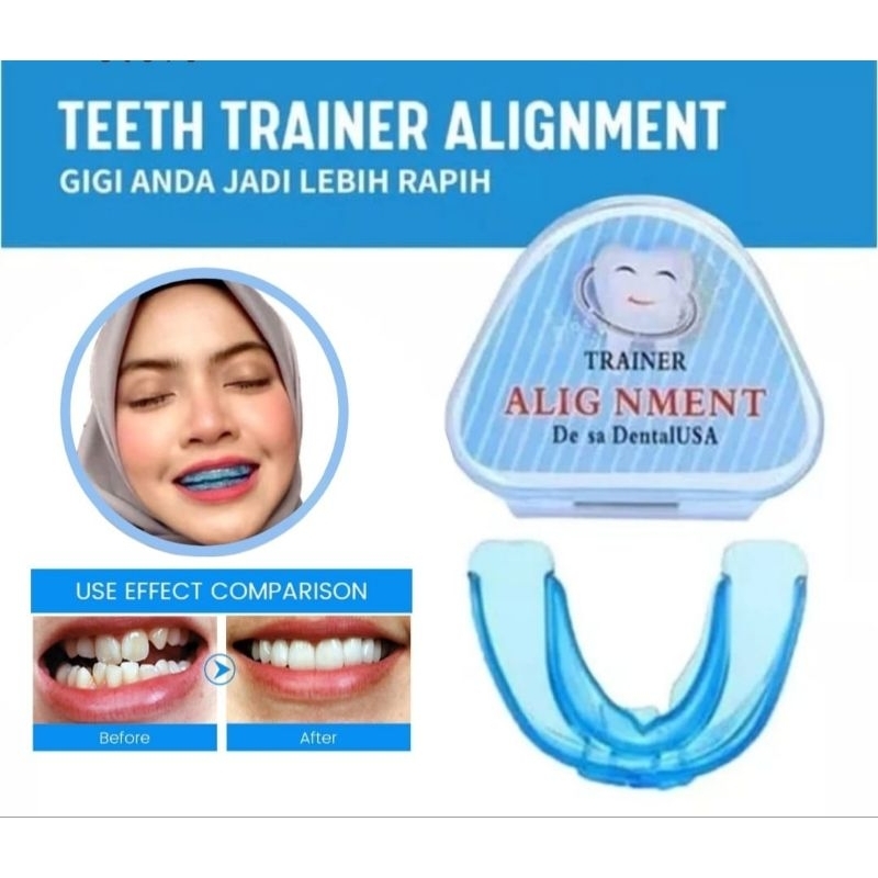 Aligner Gigi Trainer Allignment Alat Perapi Gigi Lepas Pasang Meratakan Gigi Bertahap