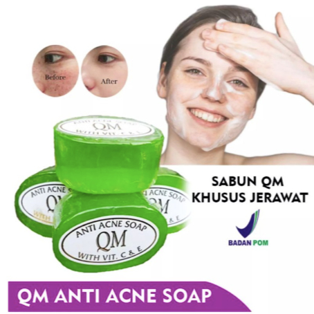 ❤LOLA❤ SABUN QM HIJAU ACNE | Sabun QM Anti Acne Soap / QM Facial Soap / Sabun Cuci Muka QM / Sabun W